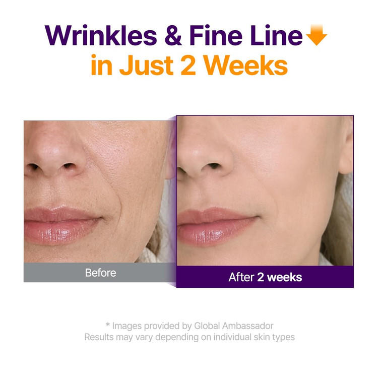 سرم جوانساز پیوریتو مدل Retinol Retinal 2000