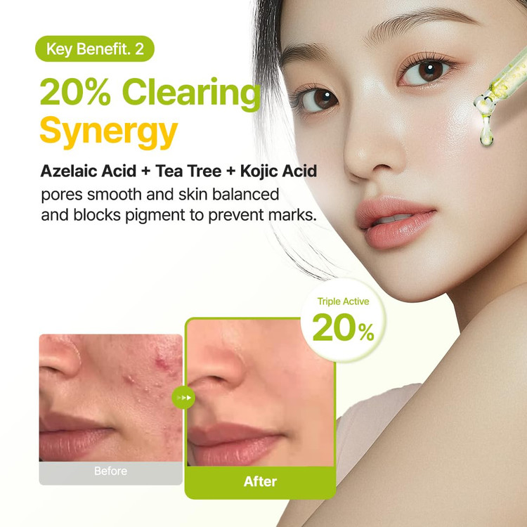 سرم آزلائیک اسید 10 درصد کوجیک اسید و تی تری پیوریتو ضد لک و جوش